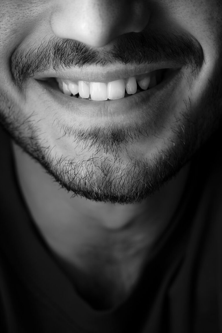 Fashion Forward: Teeth Whitening as a Trend: Best Guide for 2023