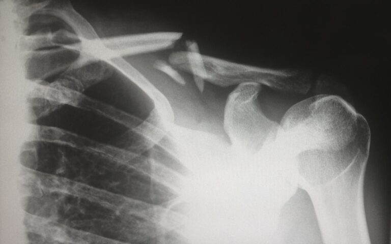 Top 5 Personal Injury Risks for San Diego Residents and How to Avoid Them