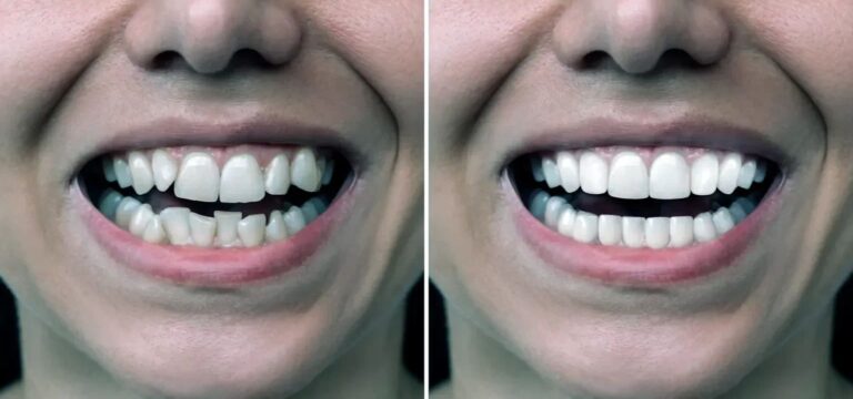 The Aesthetics of Access: Why Gen Z Is Crossing the Border for Smile Care